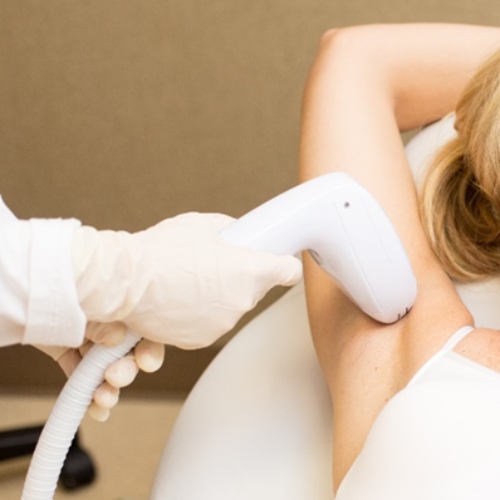 Person receiving laser hair removal treatment on armpit. Light-skinned person on a table, arm raised.