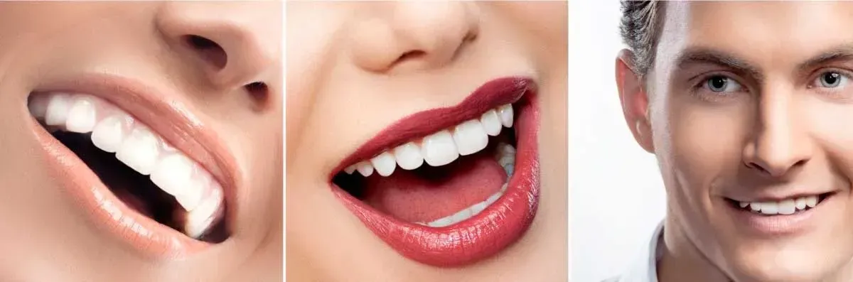 DRA. AMPARO PEÑA MARTIN DEL CAMPO - LIMPIEZA DENTAL