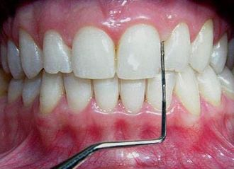 DRA. AMPARO PEÑA MARTIN DEL CAMPO - Periodoncia