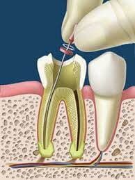 DRA. AMPARO PEÑA MARTIN DEL CAMPO - Endodoncia