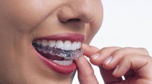 DRA. AMPARO PEÑA MARTIN DEL CAMPO - Guarda oclusal