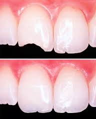 DRA. AMPARO PEÑA MARTIN DEL CAMPO - Odontología estética