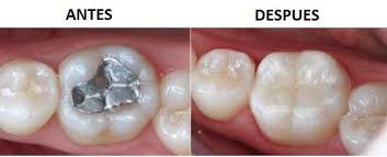 DRA. AMPARO PEÑA MARTIN DEL CAMPO - Tratamientos de odontología estética