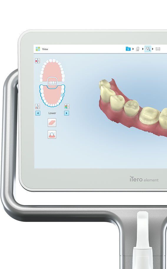 iTero scanners - Harvard Dental Centre