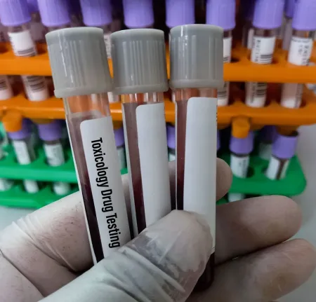 Image toxicologie – détection de substances toxiques – laboratoire Marrakech