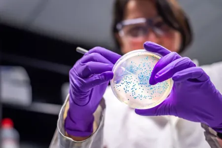 Illustration microbiologie – recherche de bactéries et infections – Labo Bab Doukkala