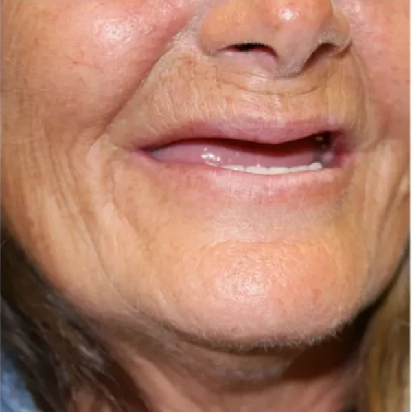 A close up of a woman 's face with her mouth open.
