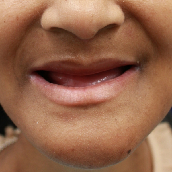 A close up of a woman 's mouth and nose
