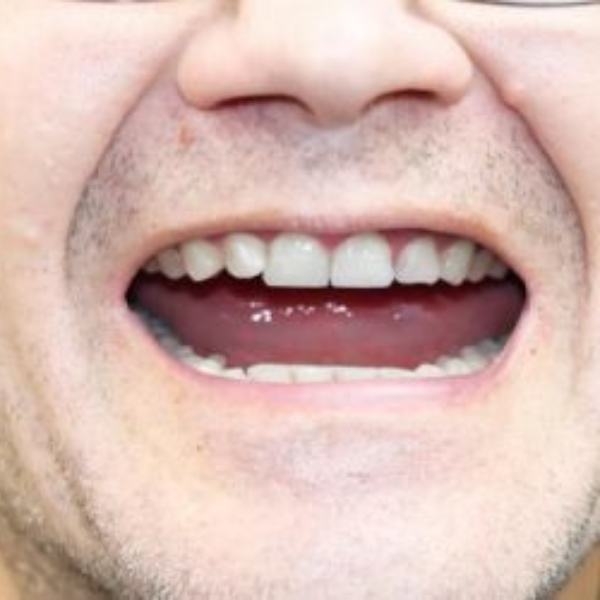 A close up of a man 's mouth with glasses on