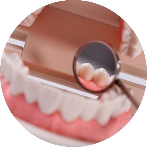 A close up of a person 's teeth with a magnifying glass