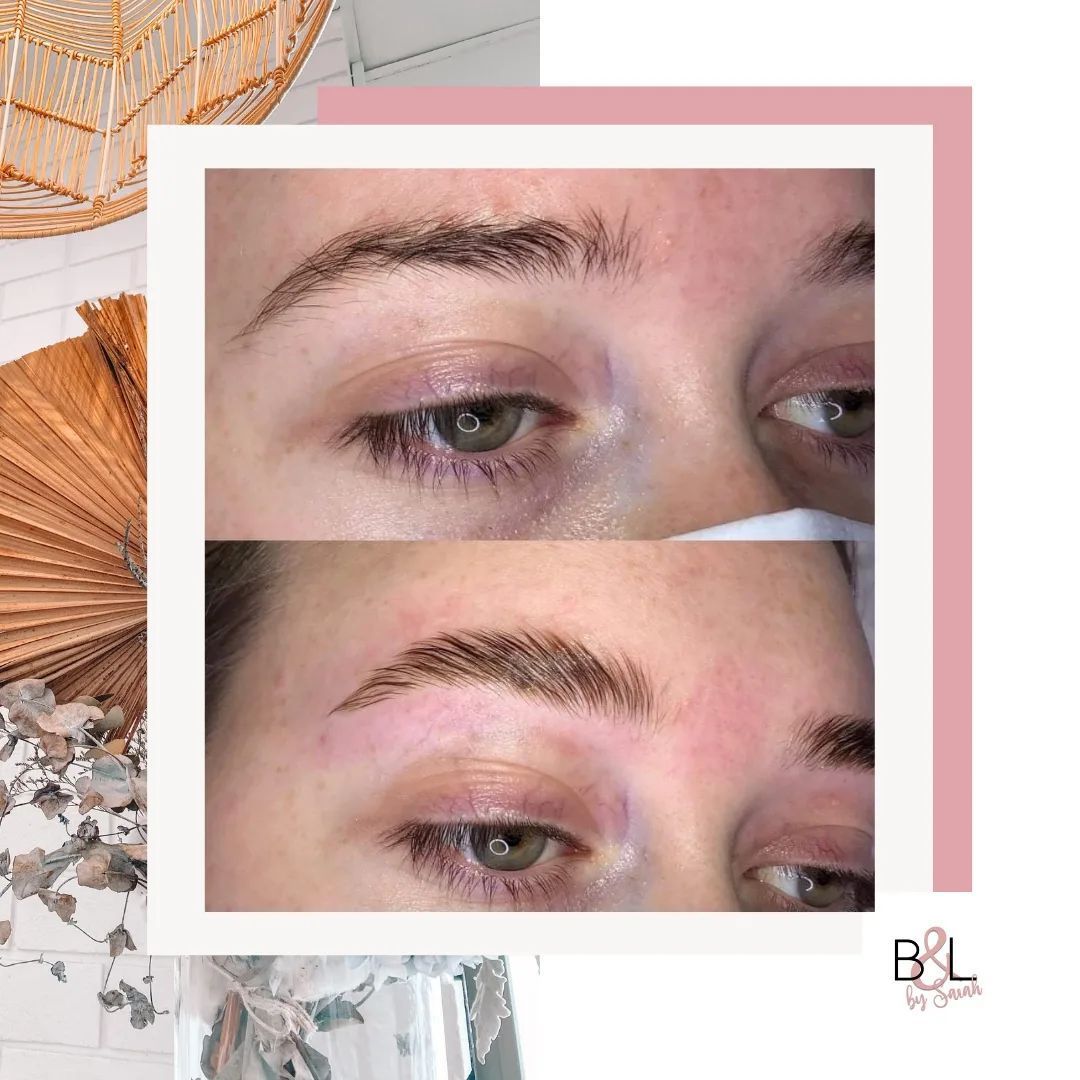 A before and after photo of a woman 's eyebrows. — Beauty & Laser by Sarah in Long Jetty, NSW