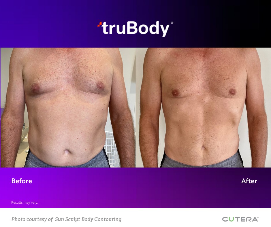 Body Contouring Jacksonville, FL Precision Medicine and Wellness by Elizabeth Bagan, APRN