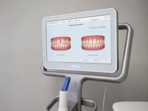 Itero Digital Scanner Harken Dental New Holland PA