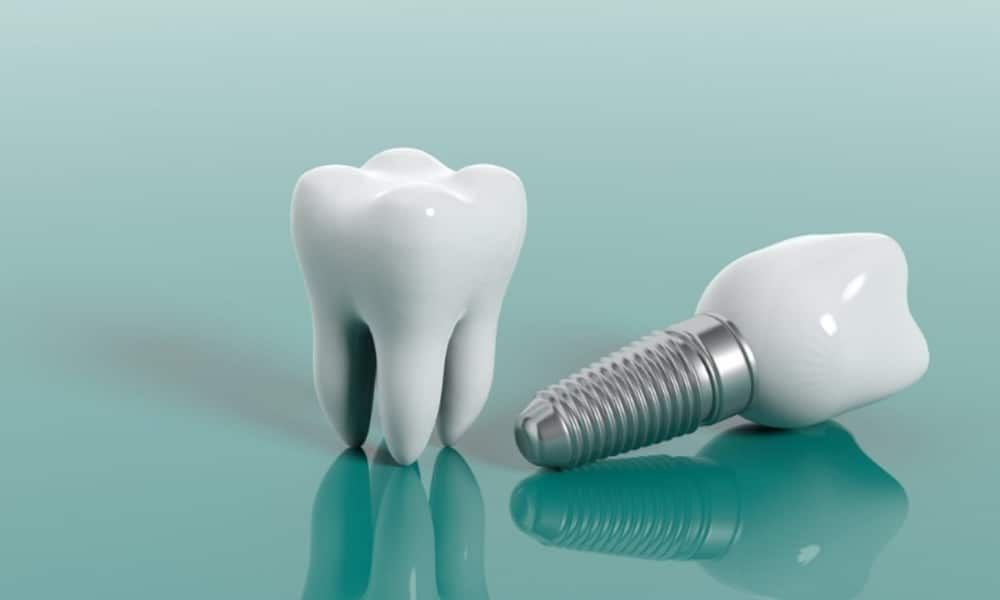 A white tooth and dental implant on a glossy teal background