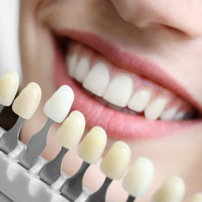patient considering Veneers | New Holland PA Dentist
