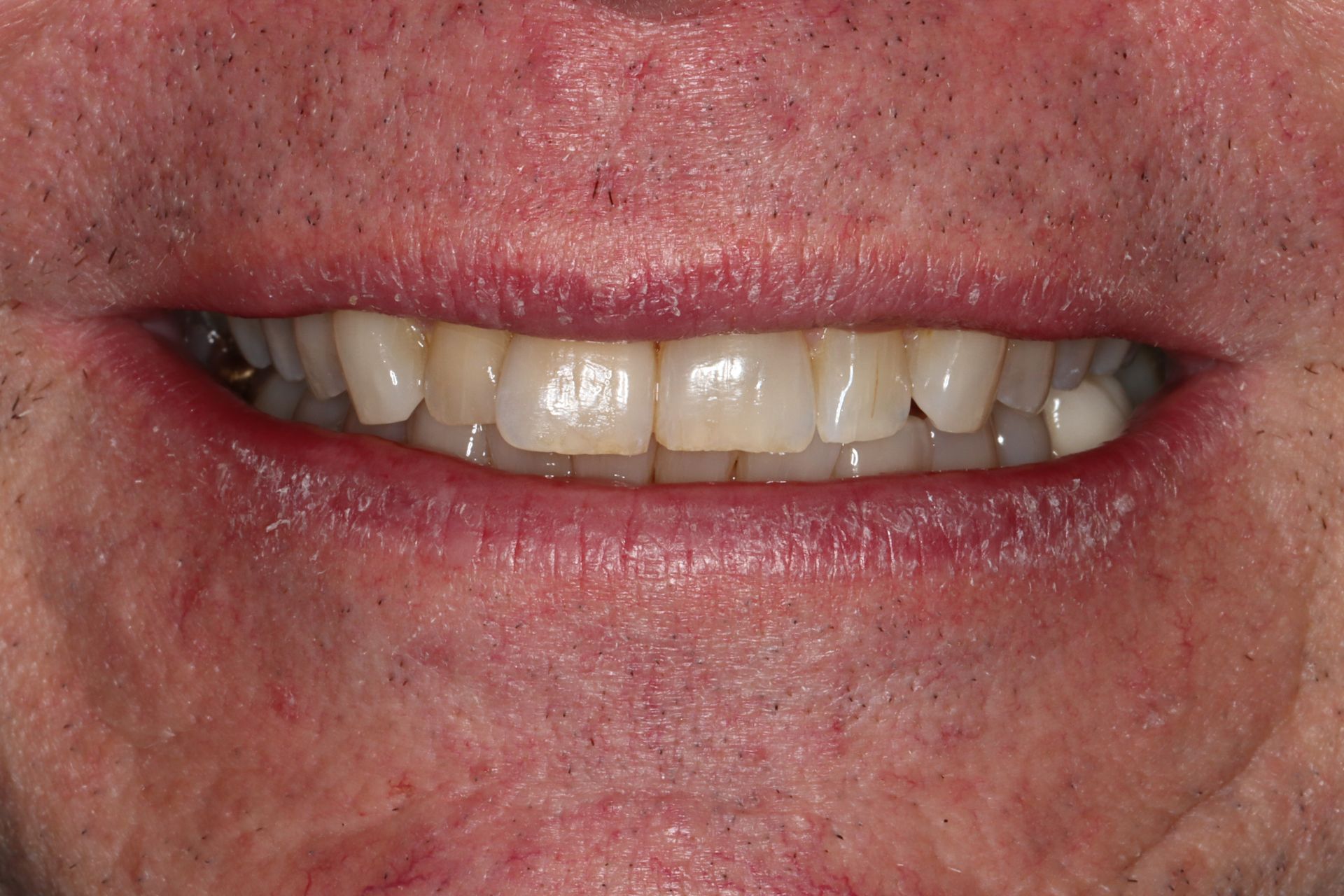 Close-up of a smiling mouth with slightly uneven teeth and pink lips
