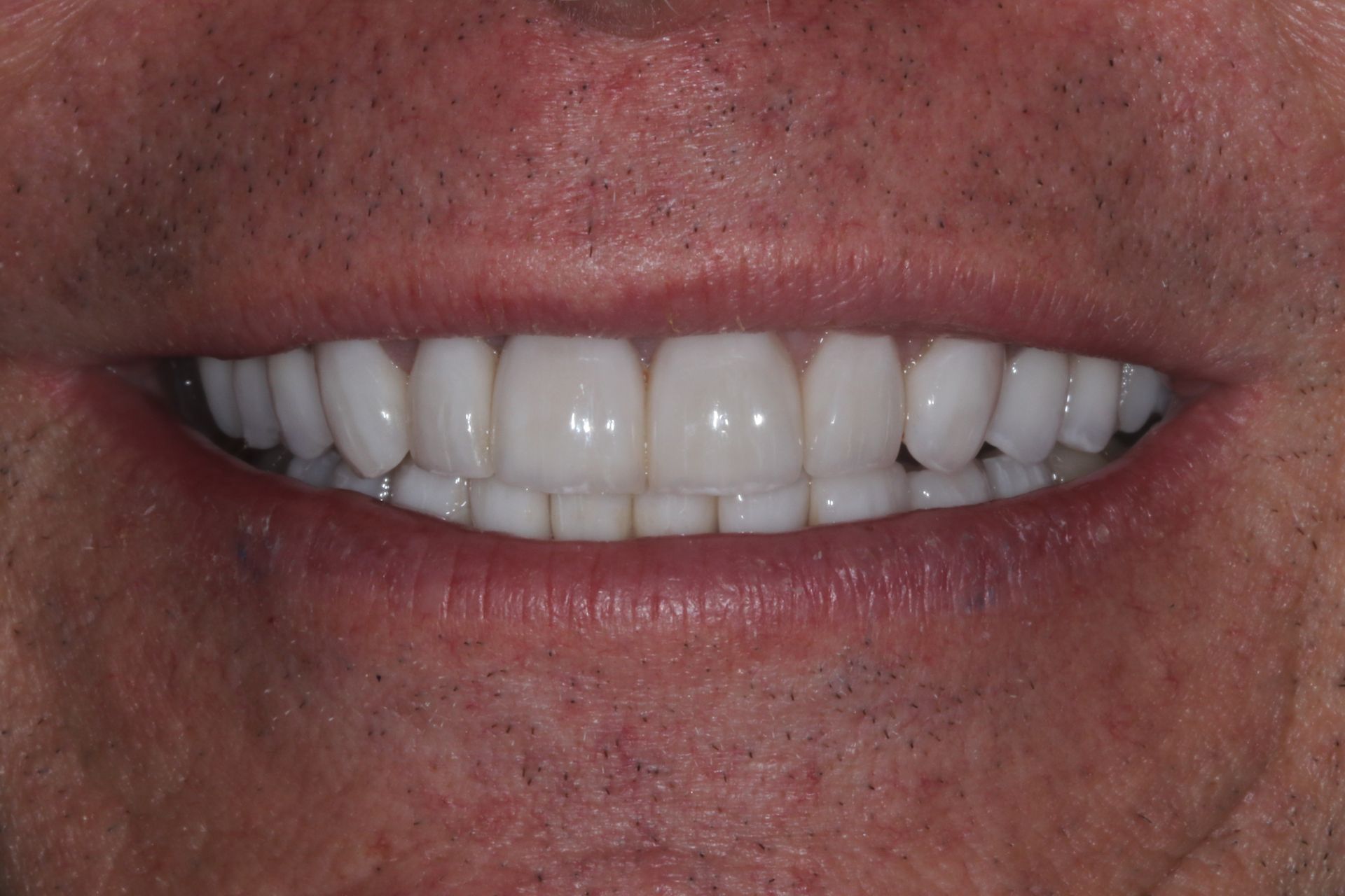Close-up of a smiling mouth with white teeth and light pink lips