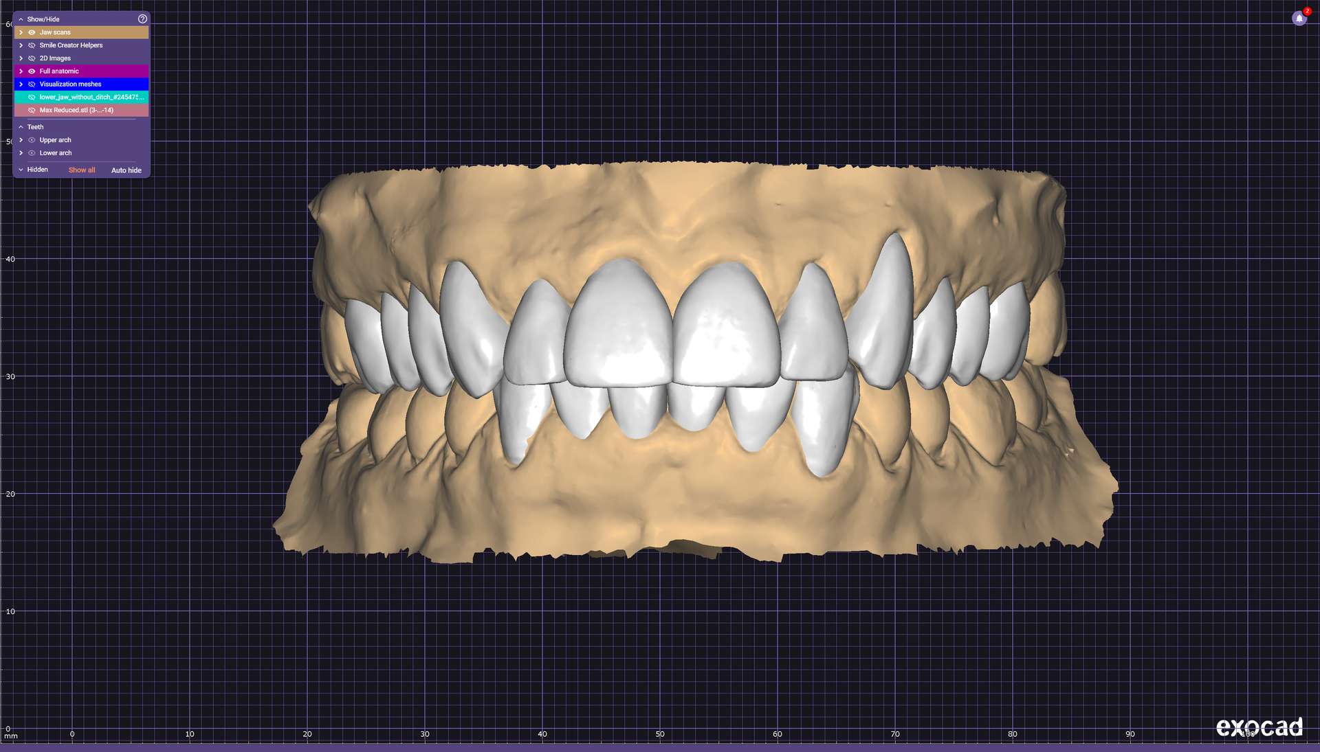 Dental scanner display showing two rows of teeth on a white touchscreen device