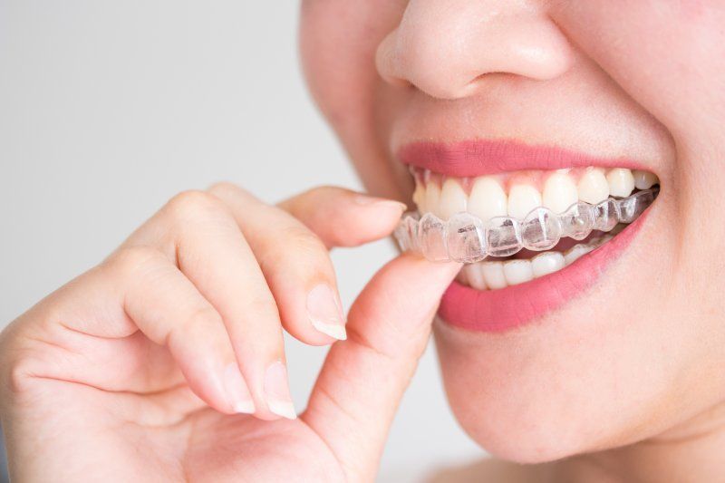 Before-and-after close-up of teeth alignment with Invisalign, showing straighter white teeth and a centered bite.