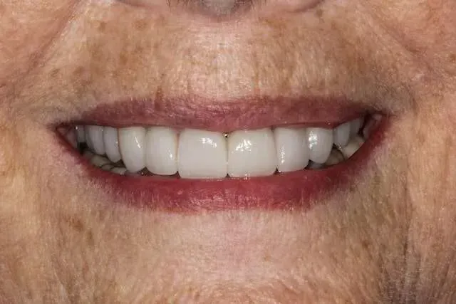 Close-up of a smiling mouth with white teeth and red lipstick