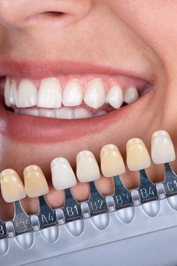 Woman having her teeth whitened at Laura S. Harkin DMD in New Holland PA