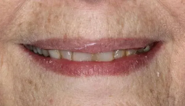 Close-up of a smiling mouth showing teeth and pink lipstick.