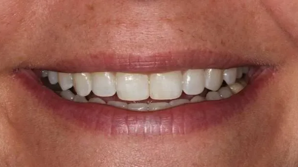 Close-up of a smiling mouth showing teeth and pink lips