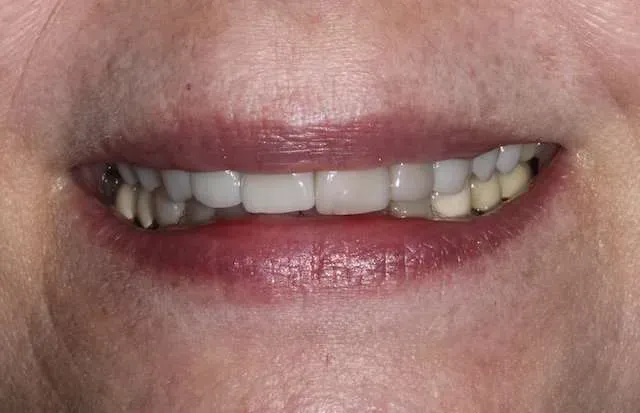 Close-up of a smiling mouth with glossy red lipstick and visible teeth