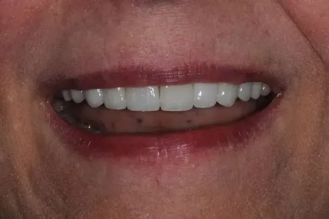 Close-up of a smiling mouth with white teeth and red lipstick