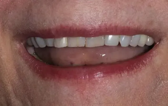 Close-up of a smiling mouth with white teeth and pink lips
