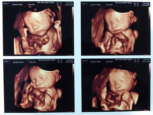 MUÑOZ ORDAZ ADA LISSETT DRA -ultrasonido