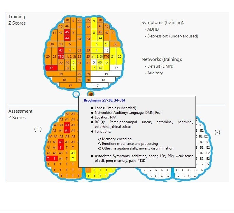 Two colorful brain heatmaps compare training and assessment z-scores with a symptom list overlay.