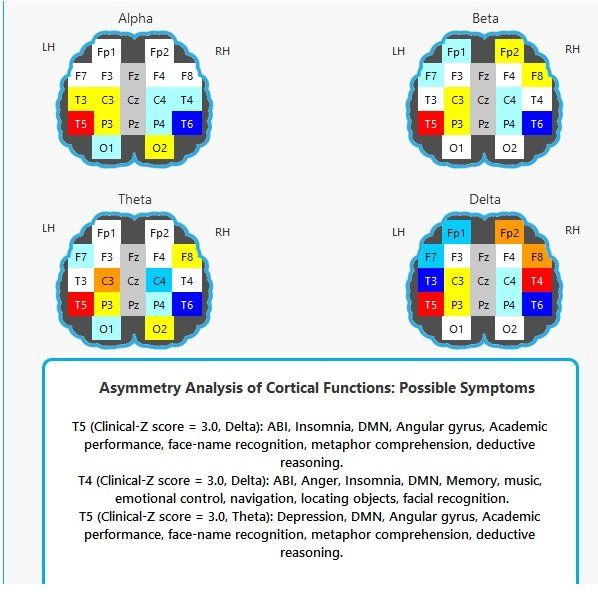 Four brain maps labeled Alpha, Beta, Theta, and Delta with color-coded cortical regions and legend text.
