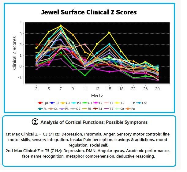 Line chart titled “Jewel Surface Clinical Z Scores” with many colored lines across two time points and legend.