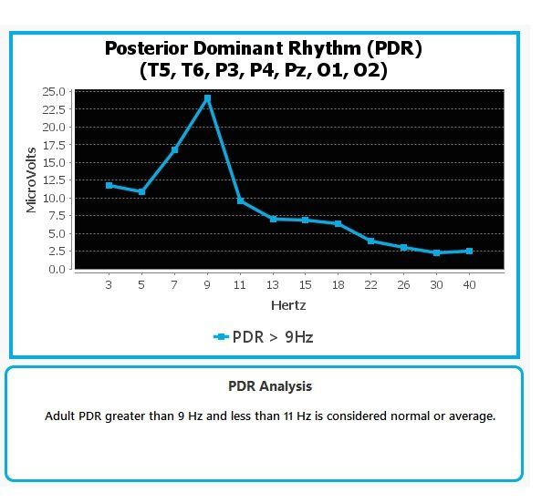 Posterior Dominant Rhythm (PDR) line chart with blue trend and note: “PDR > 9Hz” normal/average.