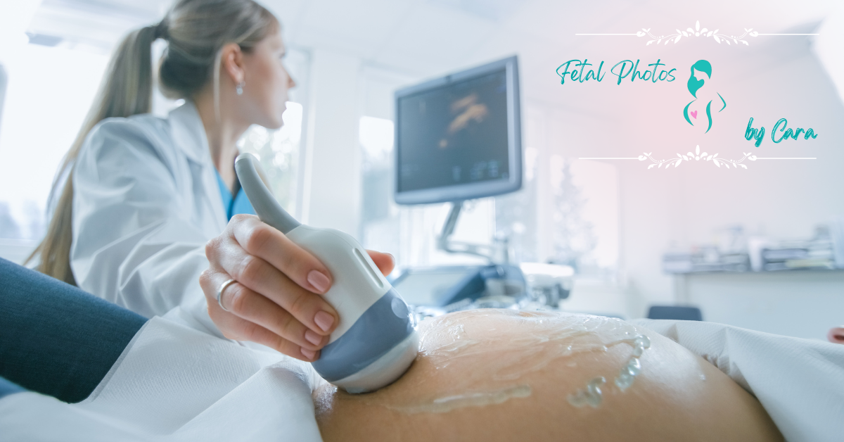 Sonogram tech performing sonogram on pregnant women