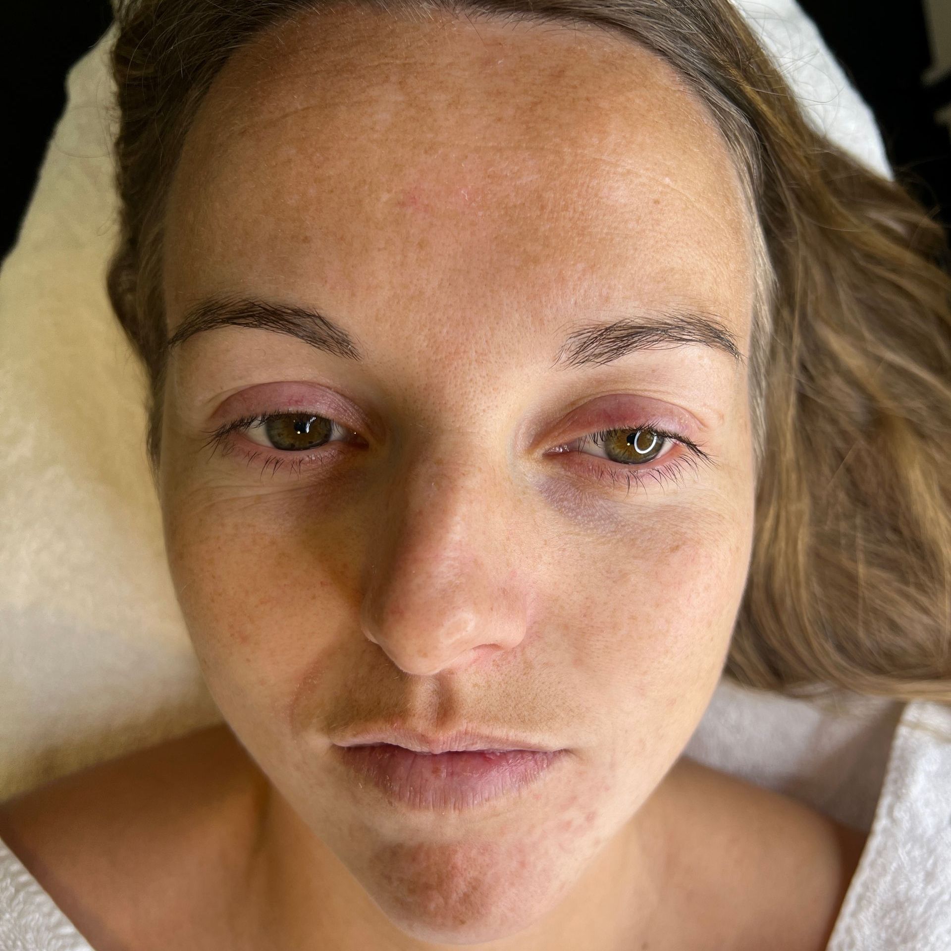 Resultaat gezichtsbehandeling bij Glow Spa in Drachten