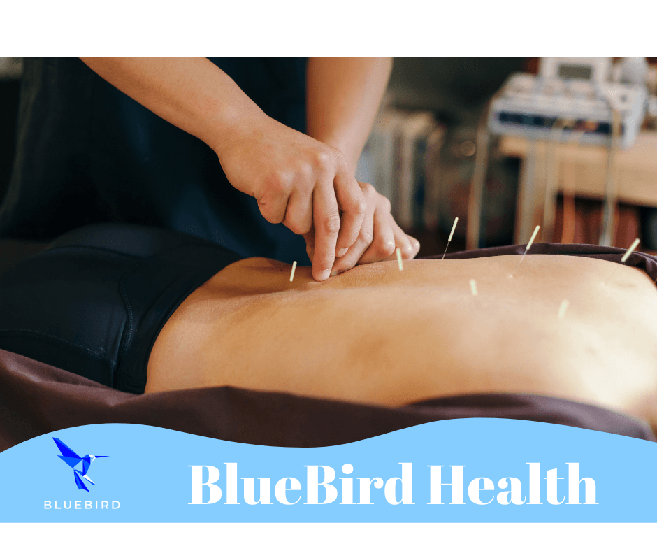 Patient receiving acupuncture at health clinic