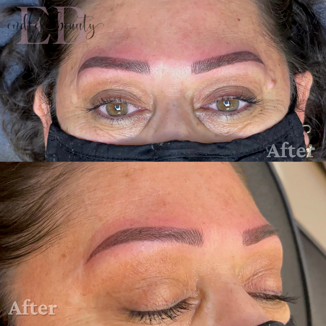 eyebrow procedure results