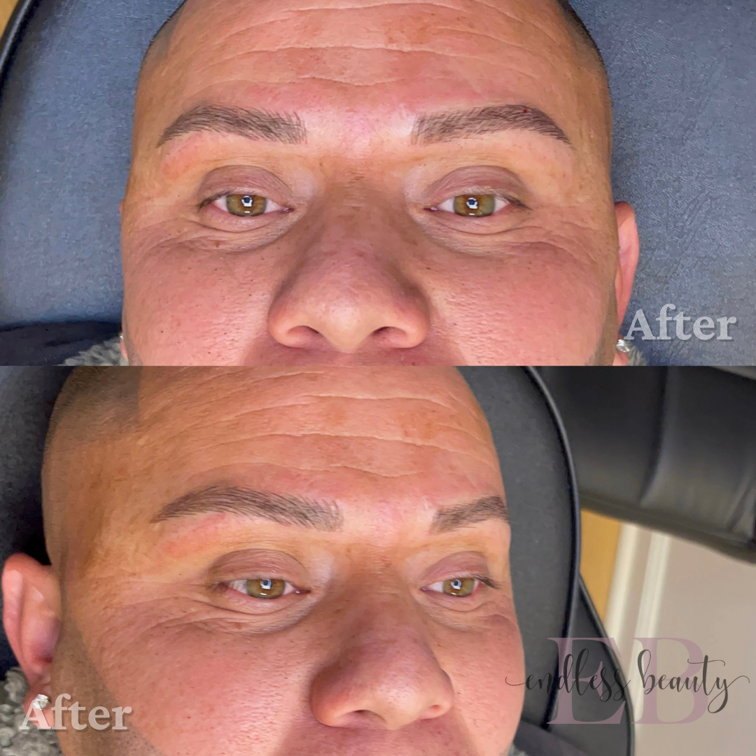 a before and after photo of a man's face