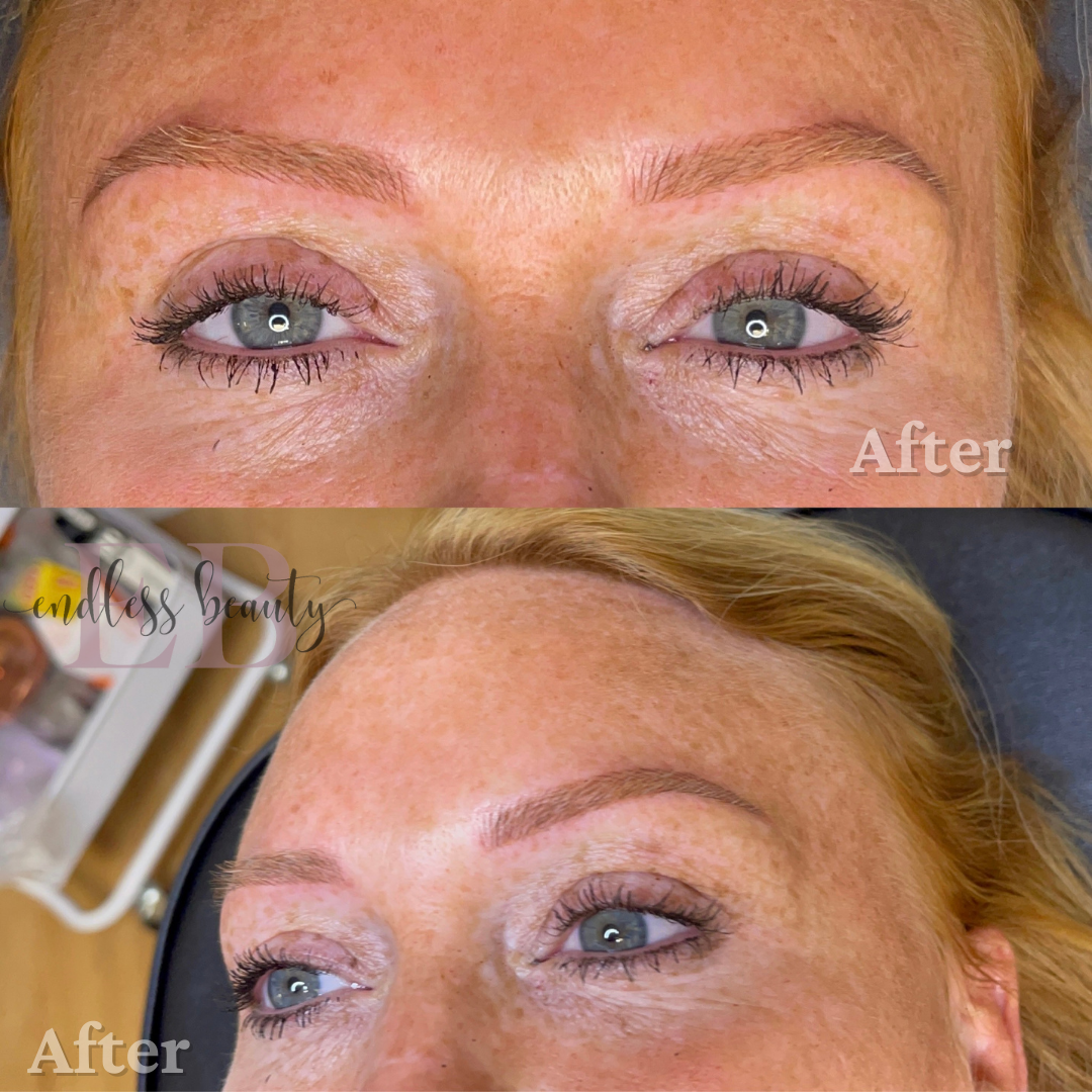 a before and after photo of a woman's eyebrows by endless beauty