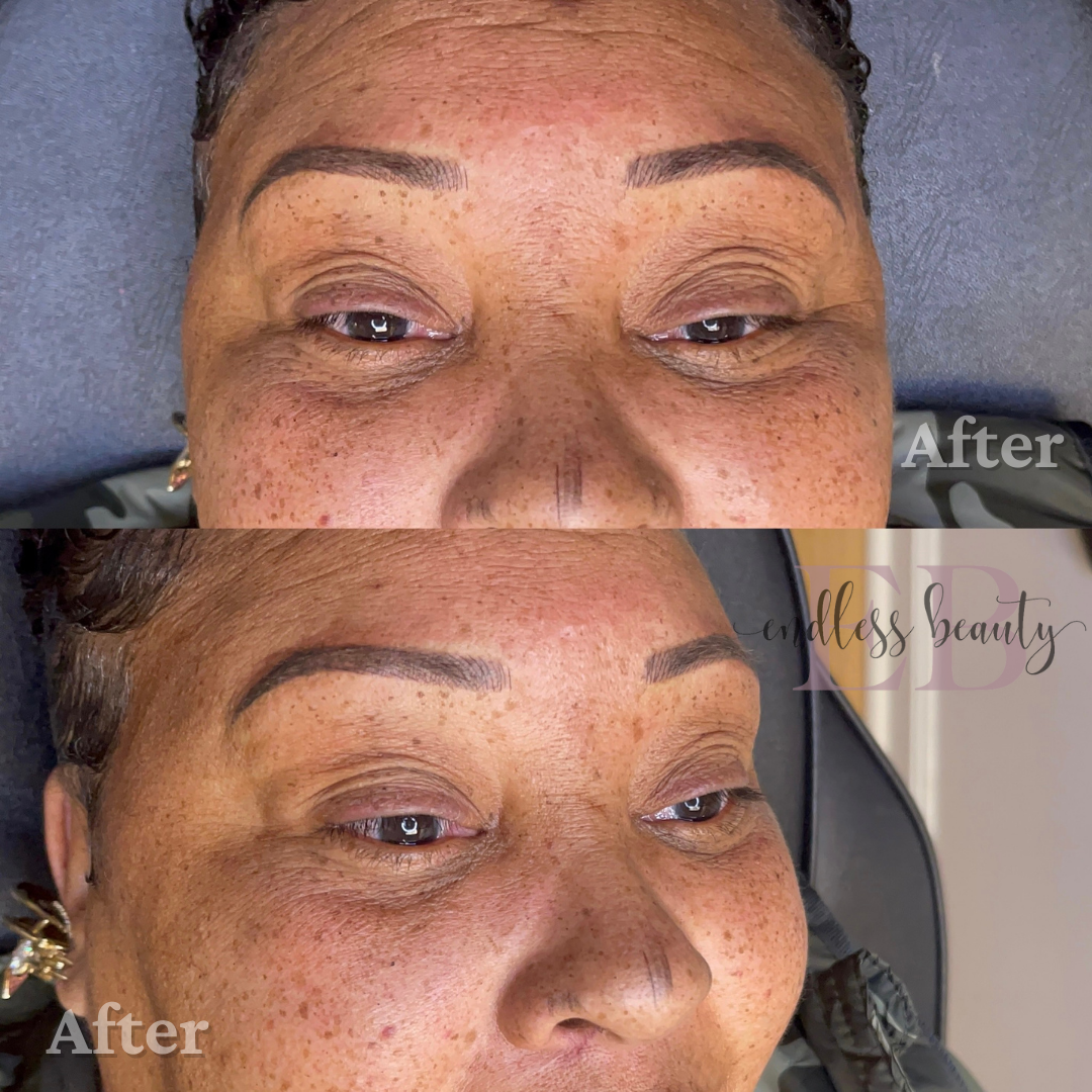 a before and after photo of a woman's face