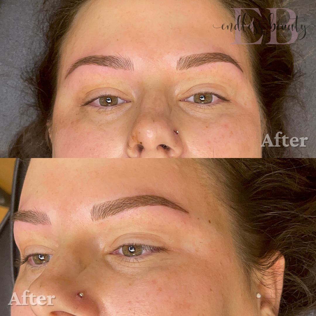 results of an eyebrow procedure