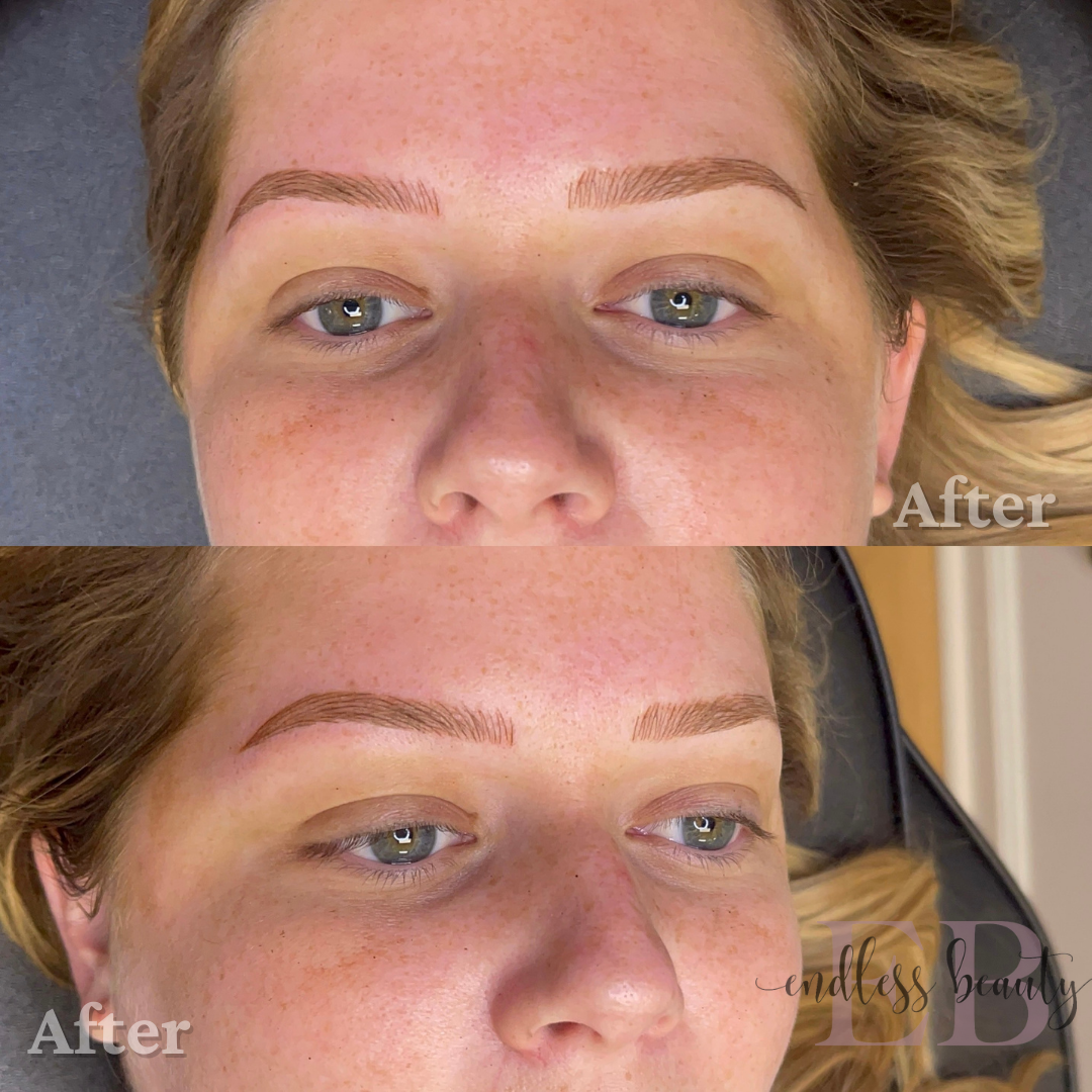 a before and after photo of a woman's face