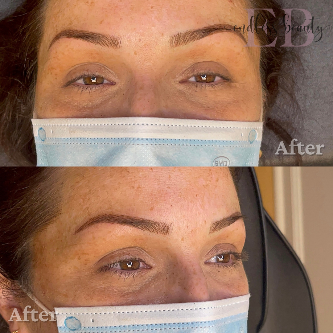 results of an eyebrow service