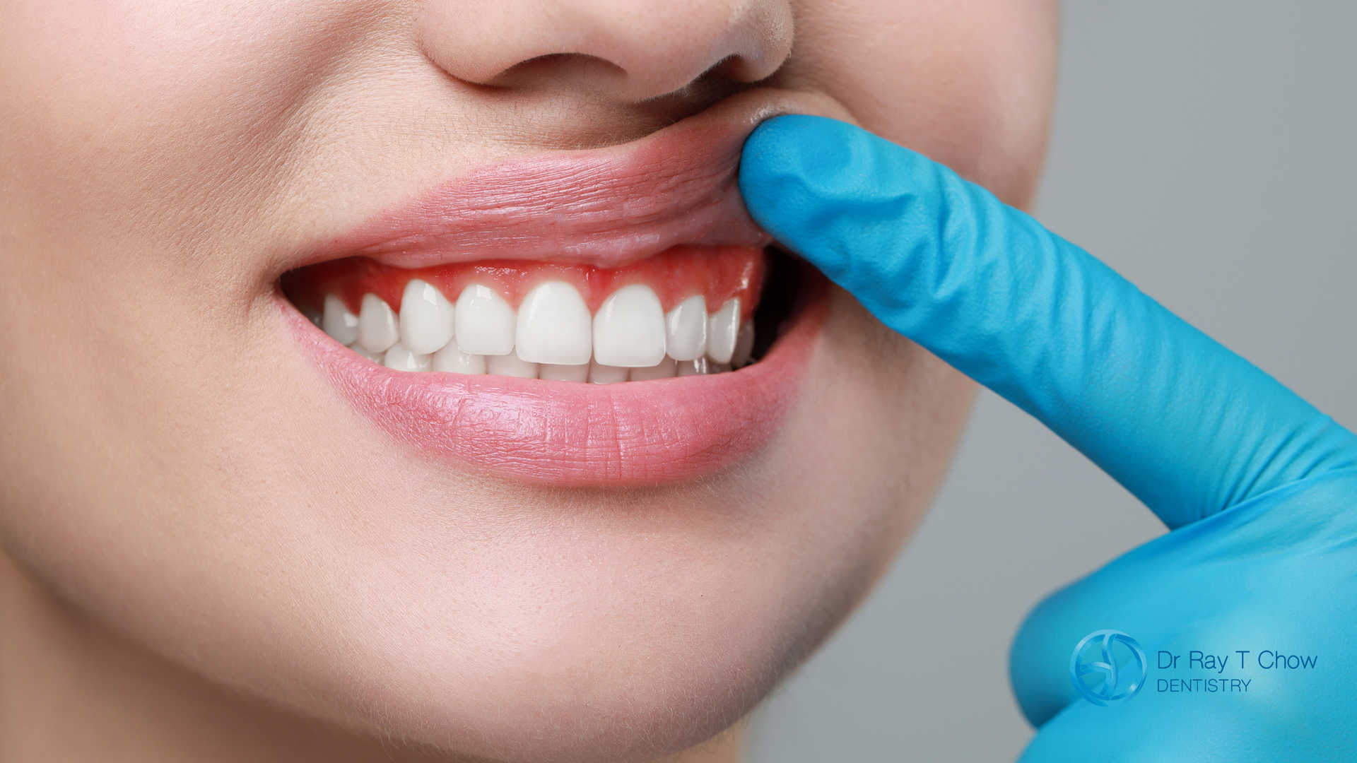 A woman is getting her teeth examined by a dentist.