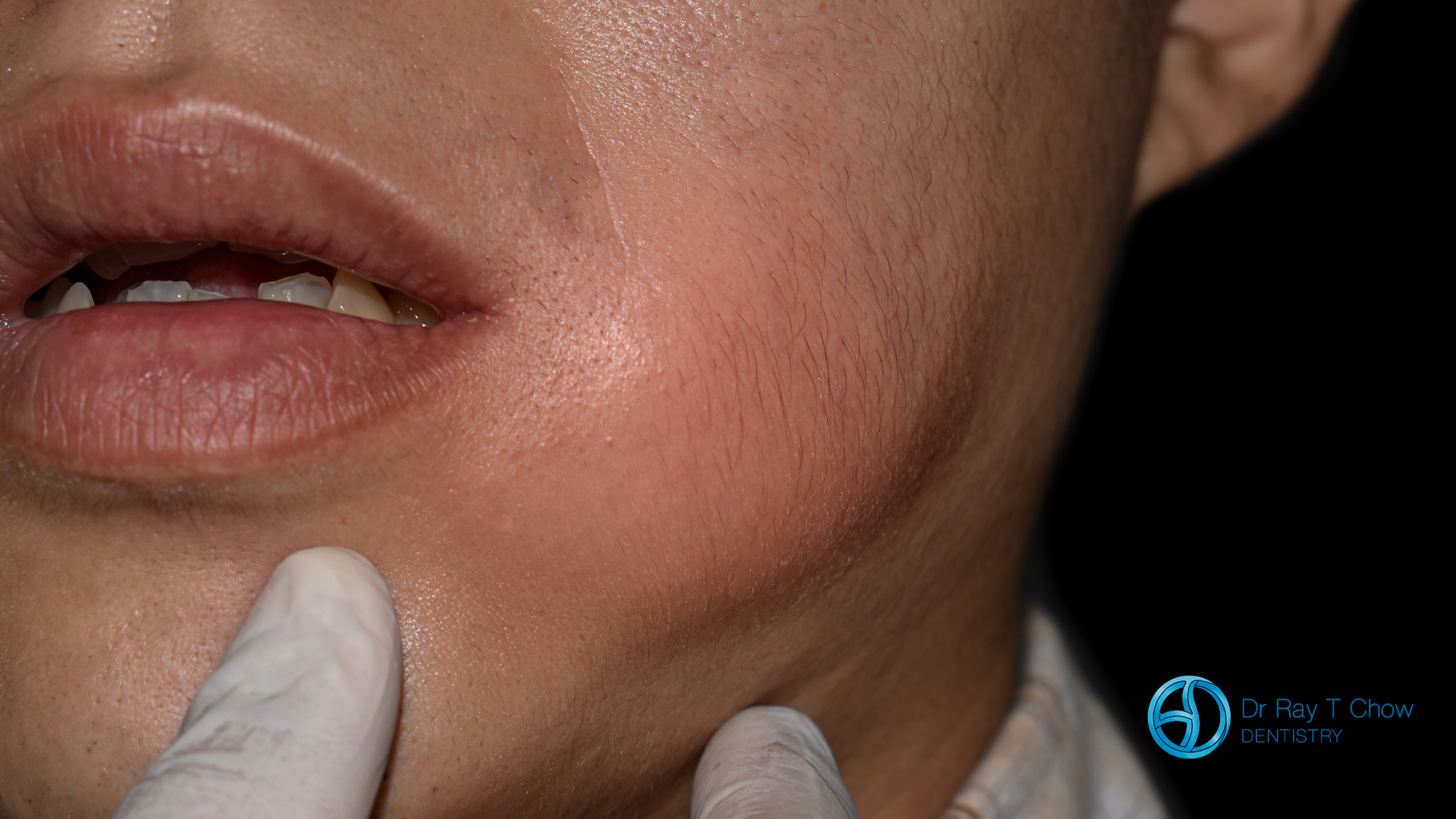 A close up of a person 's face with a glove on.