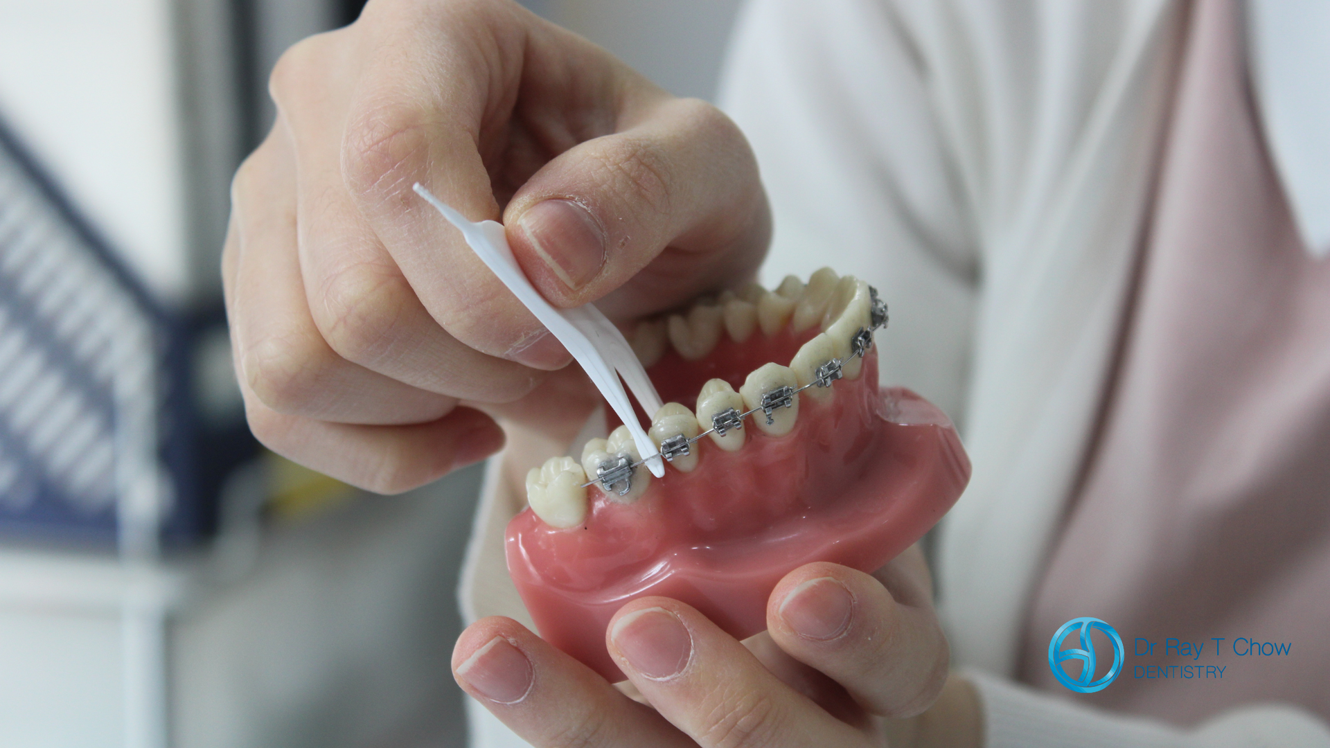 A person is holding a model of a mouth with braces on it.