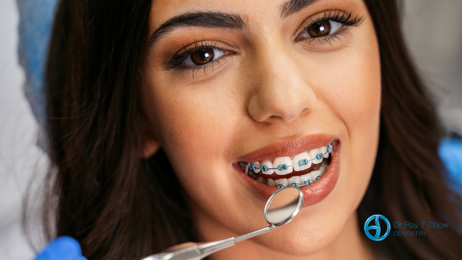 A woman with braces is getting her teeth examined by a dentist.