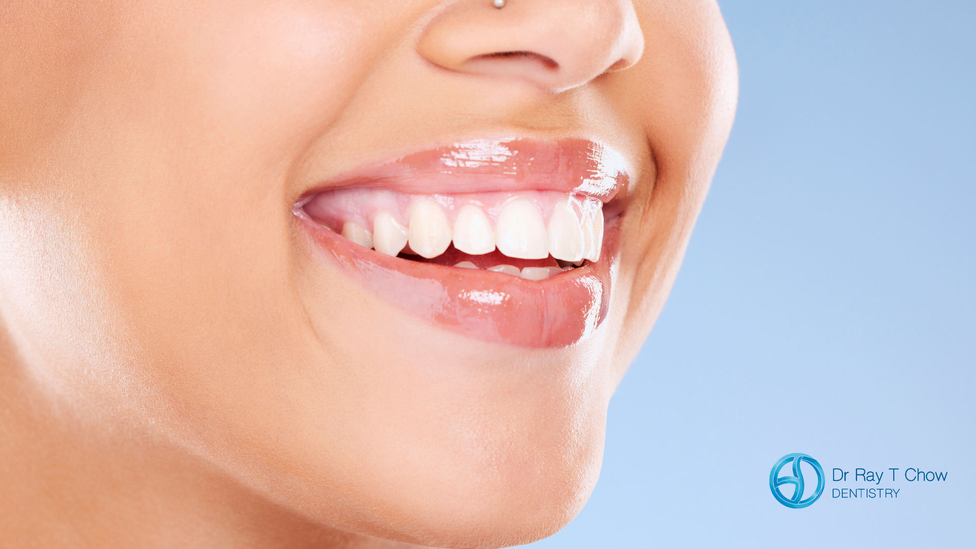A close up of a woman 's mouth with white teeth.